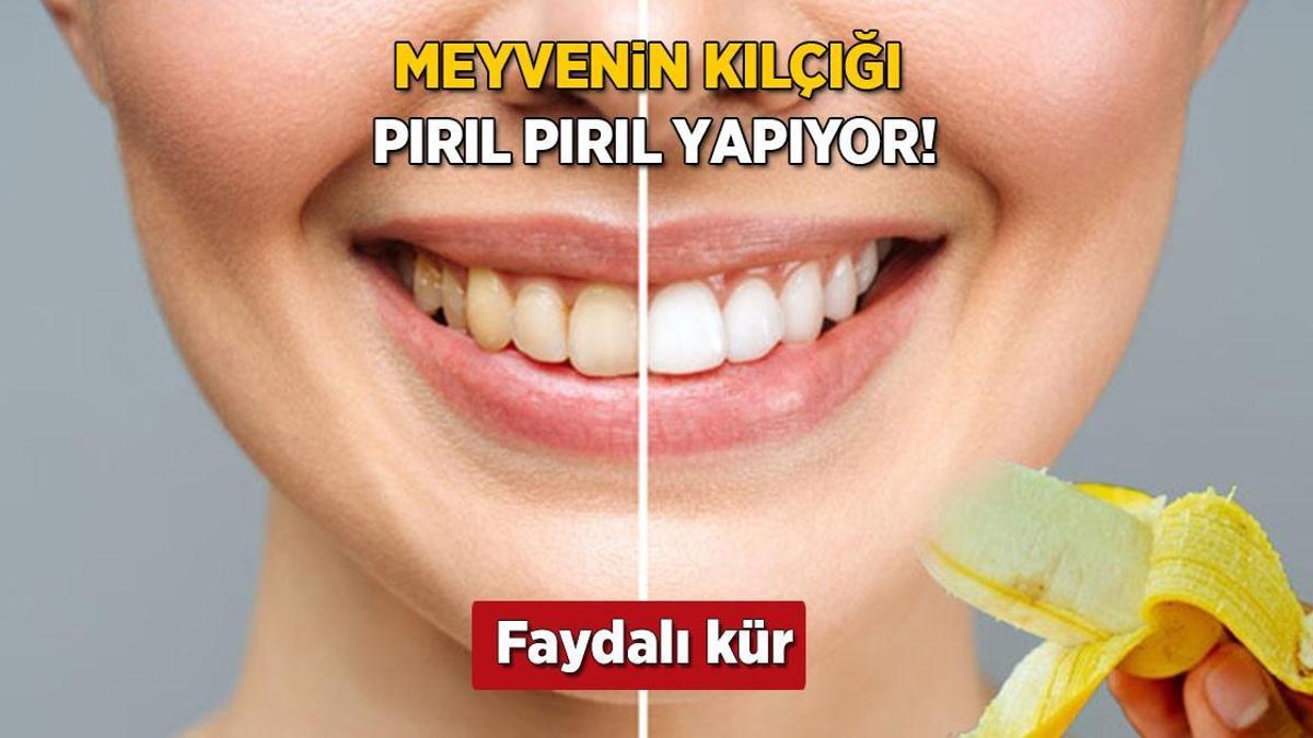 Sapsarı dişleri sakız gibi parlatan muz kılçığı! Beyazlatma işlemini rafa kaldırıyor